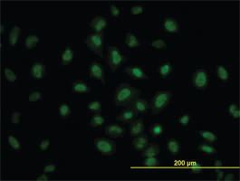 Anti-PRKAA1 Mouse Monoclonal Antibody [clone: 4D8]