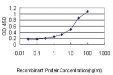 Anti-SARS Mouse Monoclonal Antibody [clone: 1H4]