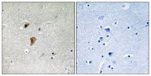 Anti-HSF1 Rabbit Polyclonal Antibody