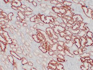 Anti-Von Hippel Lindau/VHL Mouse Monoclonal Antibody [clone: ABT-PVHL]