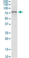 Anti-IRAK3 Mouse Monoclonal Antibody [clone: 1C9]