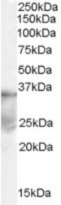 EB06857 (0.1 µg/ml) staining of human ovary lysate (35 µg protein in RIPA buffer).  Primary incubation was 1 hour.  Detected by chemiluminescence.