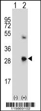 Anti-SPARC Rabbit Polyclonal Antibody