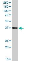 Anti-SORD Mouse Polyclonal Antibody