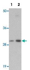 Anti-NSMCE2 Rabbit Polyclonal Antibody