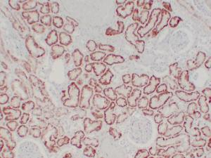 Anti-Von Hippel Lindau/VHL Mouse Monoclonal Antibody [clone: ABT-PVHL]