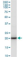 Anti-SAT1 Mouse Polyclonal Antibody