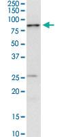 Anti-IRAK3 Mouse Monoclonal Antibody [clone: 1C9]