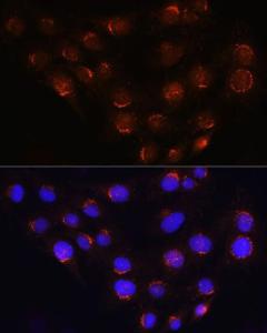 Immunofluorescence analysis of C6 cells using Anti-Golgin-245 Antibody (A11266) at a dilution of 1:100 (40X lens). DAPI was used to stain the cell nuclei (blue)