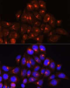 Immunofluorescence analysis of HeLa cells using Anti-Golgin-245 Antibody (A11266) at a dilution of 1:100 (40X lens). DAPI was used to stain the cell nuclei (blue)