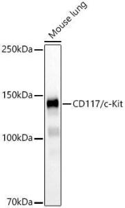 Western blot analysis of Mouse lung, using Anti-c-Kit Antibody [ARC60558] (A308779) at 1:1000 dilution