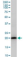 Anti-SAT1 Mouse Polyclonal Antibody