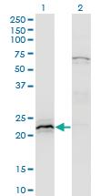 Anti-HN1 Mouse Monoclonal Antibody [clone: 3G6]