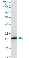 Anti-SAT1 Mouse Polyclonal Antibody