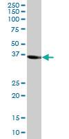 Anti-SORD Mouse Polyclonal Antibody