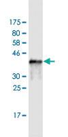 Anti-SH3BP5 Mouse Monoclonal Antibody [clone: 1D5]