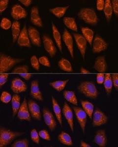 Immunofluorescence analysis of L929 cells using Anti-Golgin-245 Antibody (A11266) at a dilution of 1:100 (40X lens). DAPI was used to stain the cell nuclei (blue)