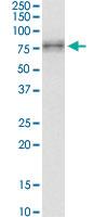 Anti-IRAK3 Mouse Monoclonal Antibody [clone: 1C9]