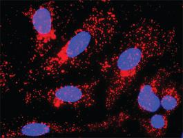 Anti-GSK3B + CTNNB1 Antibody Pair