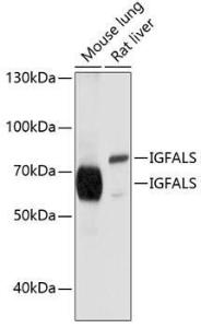 Western blot analysis of extracts of various cell lines, using Anti-ALS Antibody (A11267) at 1:1000 dilution