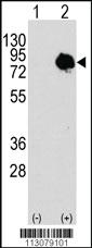 Anti-TGM2 Rabbit Polyclonal Antibody