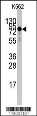 Anti-TGM2 Rabbit Polyclonal Antibody