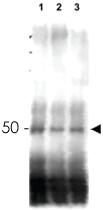 Anti-REC107 Rabbit Polyclonal Antibody