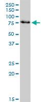 Anti-IRAK3 Mouse Monoclonal Antibody [clone: 1C9]