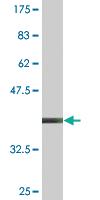 Anti-PPARGC1A Mouse Monoclonal Antibody [clone: 3G11]