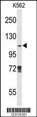 Anti-KDM4B Rabbit Polyclonal Antibody (AP (Alkaline Phosphatase))