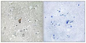 Immunohistochemical analysis of paraffin-embedded human brain using Anti-APC1 (phospho Ser355) Antibody. The right hand panel represents a negative control, where the antibody was pre-incubated with the immunising peptide.