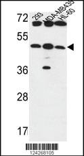 Anti-B3GNT5 Rabbit Polyclonal Antibody