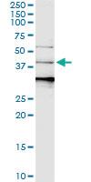 Anti-SERPINB3 Rabbit Polyclonal Antibody