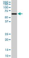 Anti-RAD18 Mouse Monoclonal Antibody [clone: 3H7]