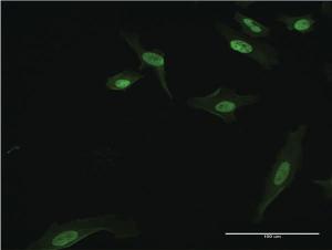 Anti-BATF3 Mouse Monoclonal Antibody [clone: 3H1]