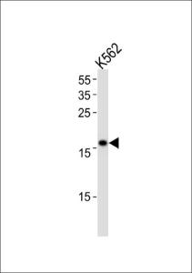 Anti-POLE3 Rabbit Polyclonal Antibody