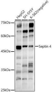 Western blot analysis of extracts of various cell lines, using Anti-SEPT4 Antibody (A11271) at 1:500 dilution