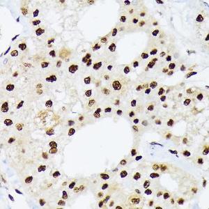 Anti-hnRNP Q antibody