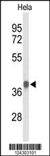 Anti-PDHA1 Rabbit Polyclonal Antibody