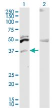 Anti-ITM2B Rabbit Polyclonal Antibody