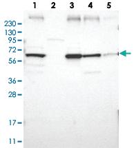 Anti-CLCC1 Rabbit Polyclonal Antibody