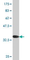 Anti-MSRB2 Mouse Monoclonal Antibody [clone: 3F12]