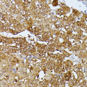 Immunohistochemistry analysis of paraffin-embedded rat liver using Anti-SEPT4 Antibody (A11271) at a dilution of 1:100 (40X lens). Perform microwave antigen retrieval with 10 mM PBS buffer pH 7.2 before commencing with IHC staining protocol