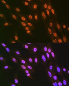 Anti-hnRNP Q antibody