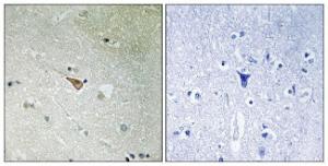 Immunohistochemical analysis of paraffin-embedded human brain using Anti-ALK (phospho Tyr1096) Antibody. The right hand panel represents a negative control, where the antibody was pre-incubated with the immunising peptide.