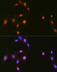 Anti-hnRNP Q antibody