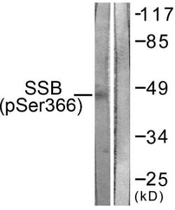 Western blot analysis of lysates from 293 cells using Anti-SSB (phospho Ser366) Antibody. The right hand lane represents a negative control, where the antibody is blocked by the immunising peptide