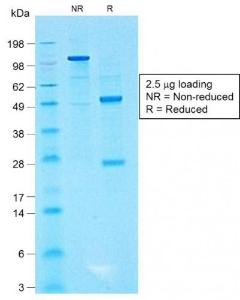 SDS-PAGE analysis of Anti-CD99 Antibody [MIC2/1495R] under non-reduced and reduced conditions; showing intact IgG and intact heavy and light chains, respectively SDS-PAGE analysis confirms the integrity and purity of the antibody