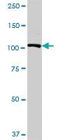 Anti-USP10 Rabbit Polyclonal Antibody