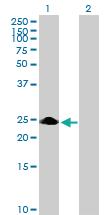 Anti-ZNF486 Mouse Polyclonal Antibody